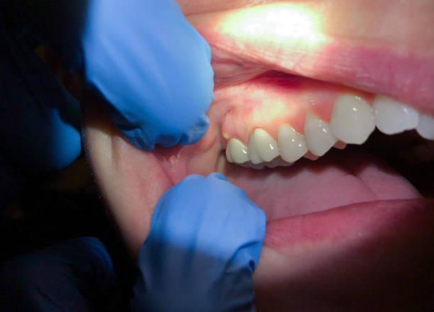 Best Teeth Whitening  in Sabina, OH